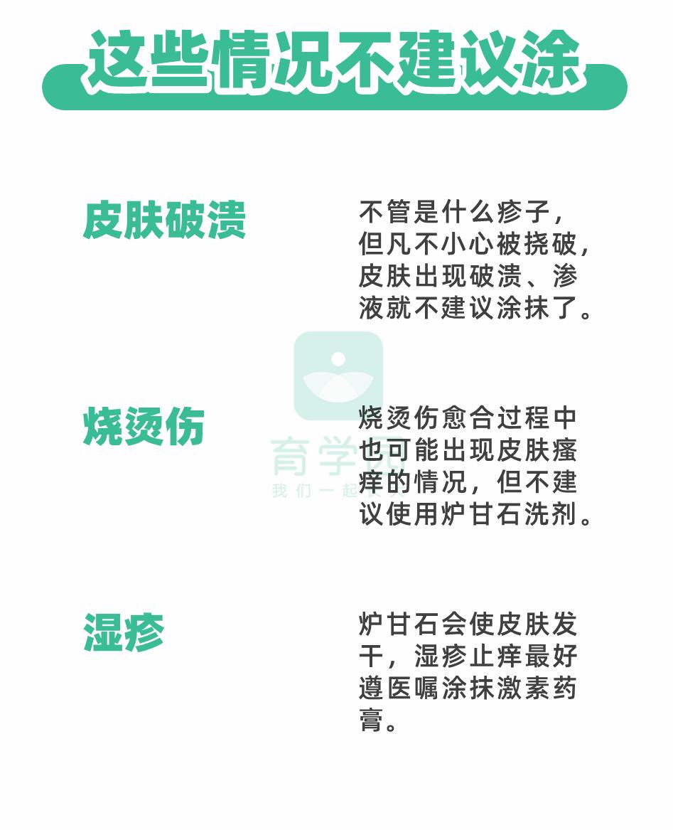 炉甘石不可以涂哪里,炉甘石不能配伍中药