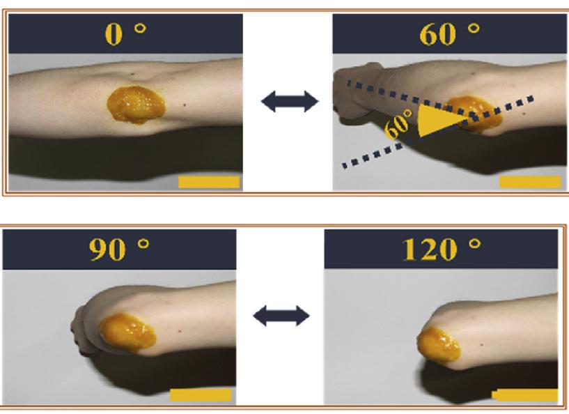 美食→生物材料|小龙虾和螃蟹→伤口敷料