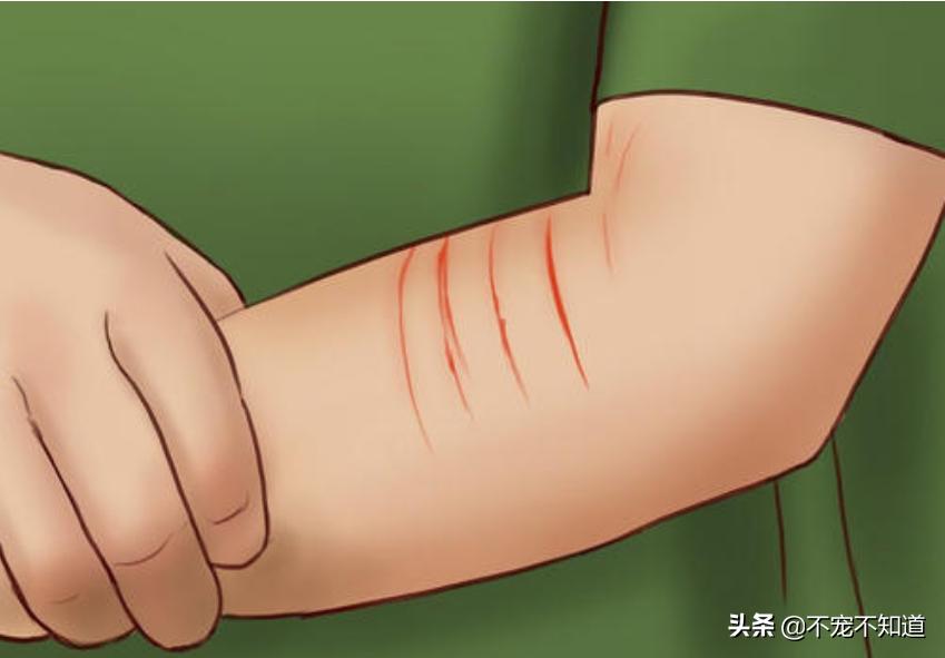 家里的猫咪抓伤要不要打狂犬疫苗,打了狂犬疫苗的猫咪抓伤了怎么办