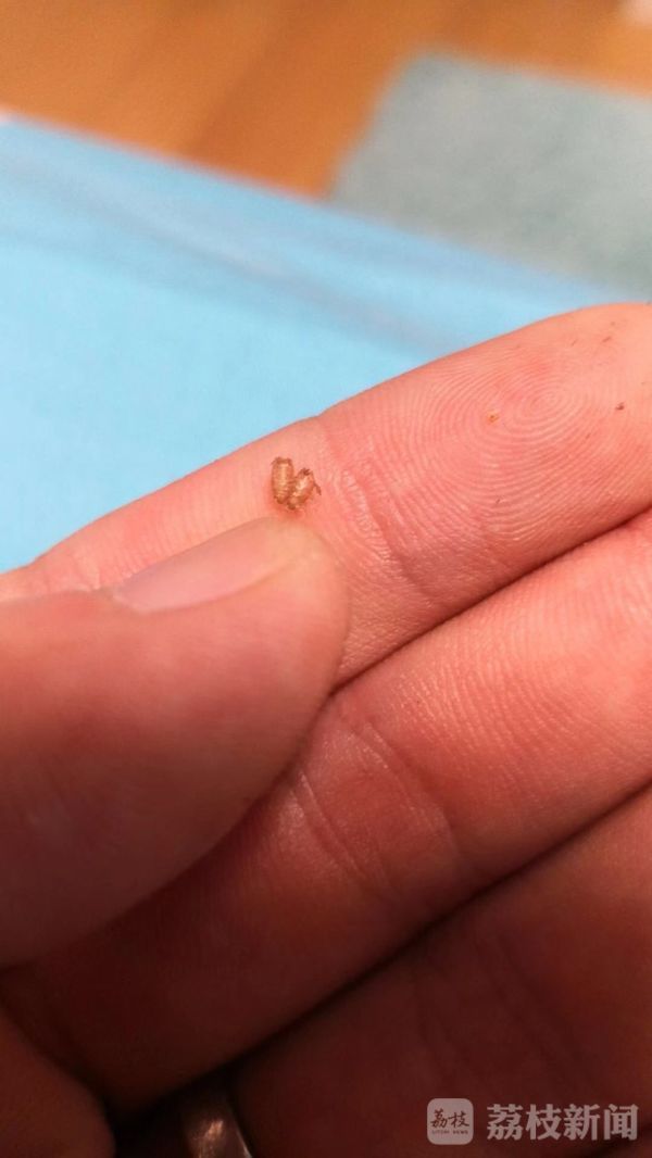 住小区楼层低有各种虫子,小区房子大面积出现虫子