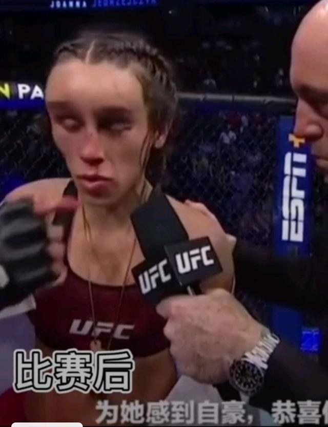 张伟丽为何能赢乔安娜,张伟丽为啥能夺冠