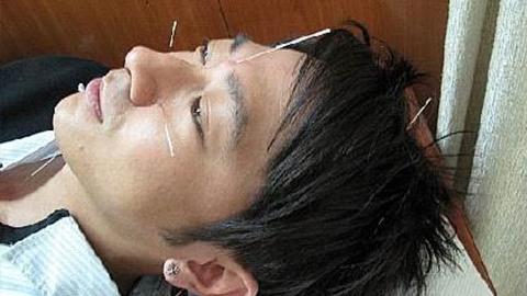 选择针灸,选针灸推拿学的理由