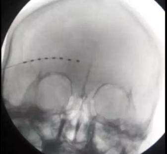 看到泗阳这名老太的样子，你还敢相信偏方吗？