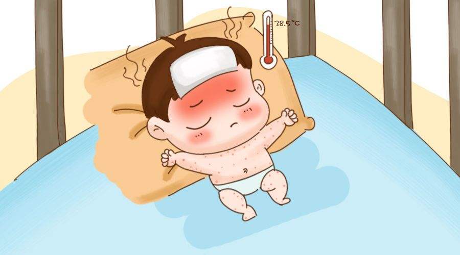 疫情期间可以买退烧药吗,现在疫情期间宝宝发烧了怎么办