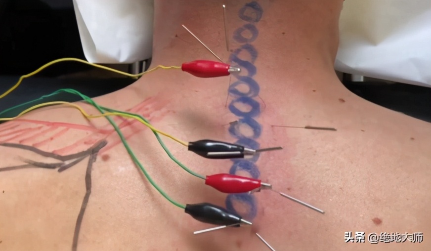 慢性颈痛推拿手法,慢性颈肩腰腿痛中医调养视频