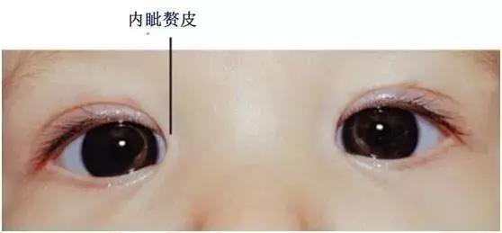 床头吊着的宝宝玩具,床头玩具会导致宝宝斗鸡眼吗