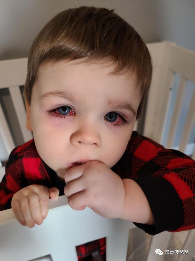 蠢萌蠢萌的洗澡鸭，差点让我儿子失去了一只眼