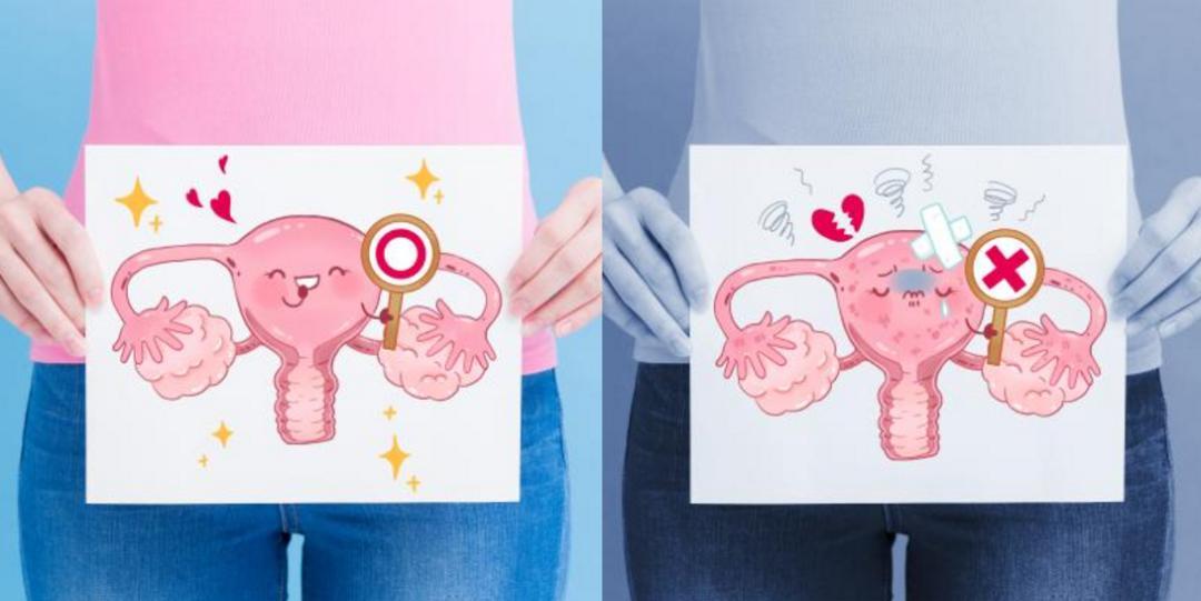 月经前十天脸上起痘痘怎么回事,月经期间身上长红痘痘是怎么回事