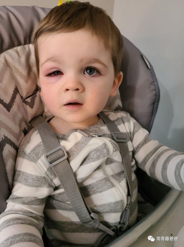 蠢萌蠢萌的洗澡鸭，差点让我儿子失去了一只眼