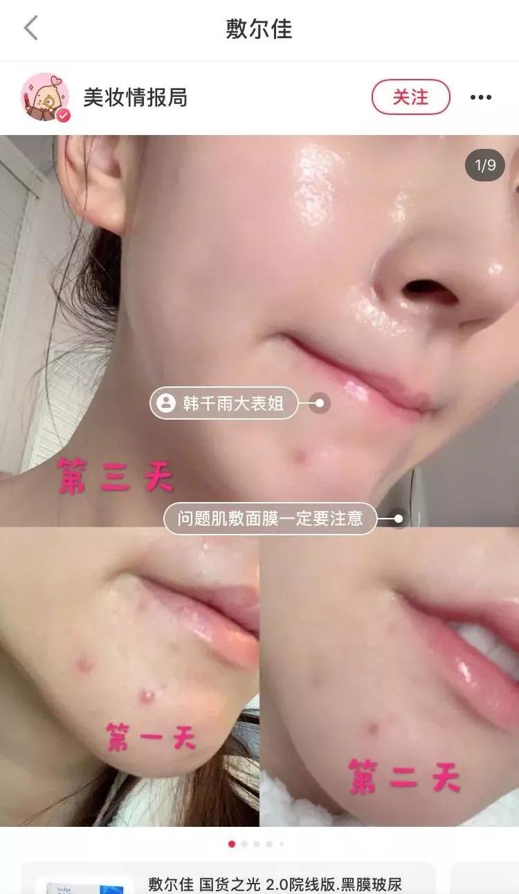 敷尔佳面膜测评红黑榜,国货面膜爆款榜敷尔佳