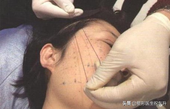 线雕后听到嘎嘣的声音怎么办,做了线雕打哈欠咯噔咯噔响