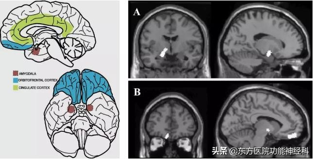 精神病人的前世,精神科药物的前世今生