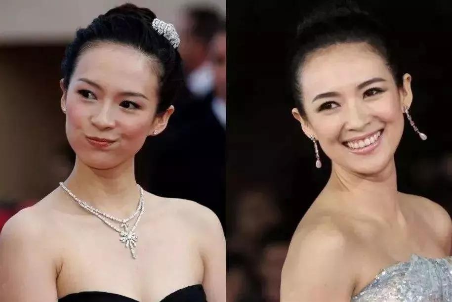 有颈纹和没有颈纹的女人,女人有颈纹怎么办