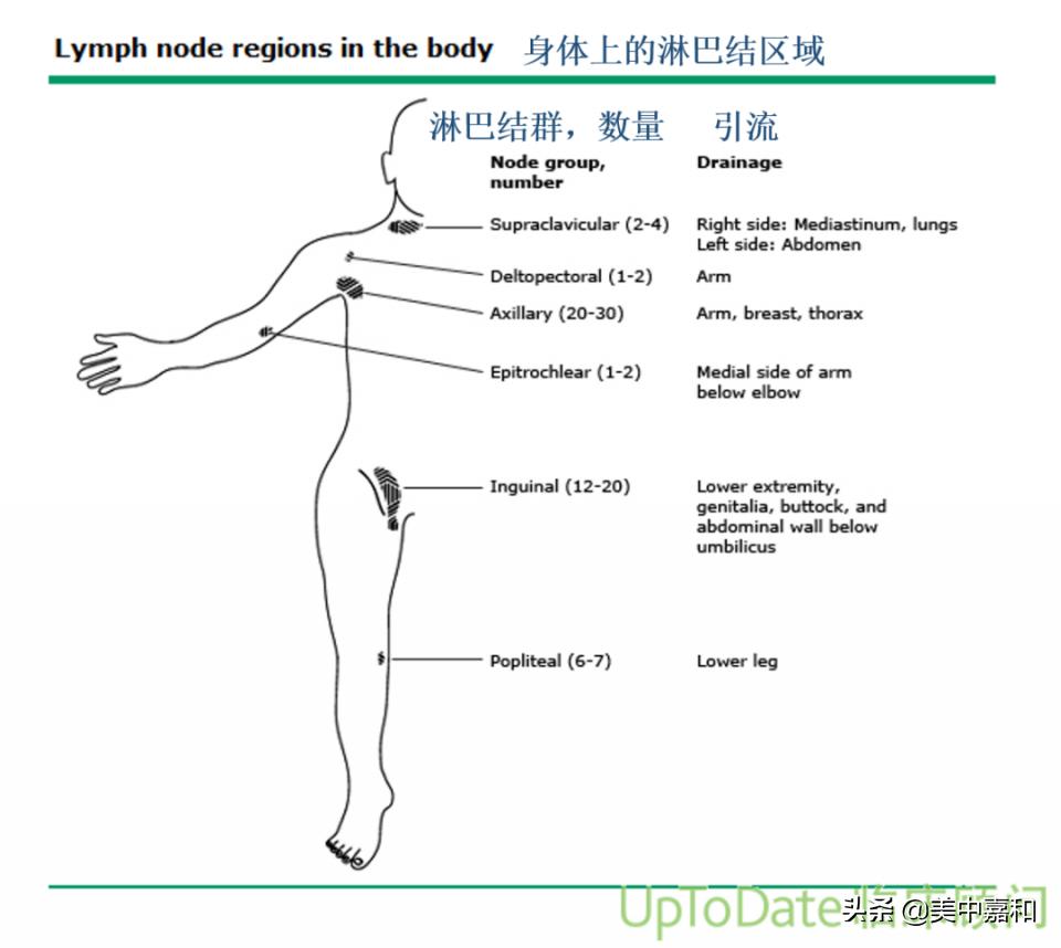 肢体慢性淋巴水肿属于哪种水肿,淋巴水肿了要怎么处理