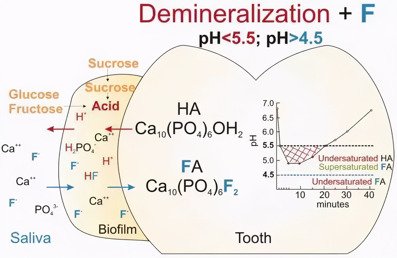 牙齿脱矿了如何补救,牙齿脱矿了怎么治