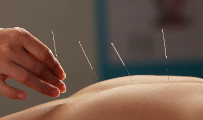 腰椎间盘突出什么方法治疗好得快,腰椎间盘突出最新的治疗方法