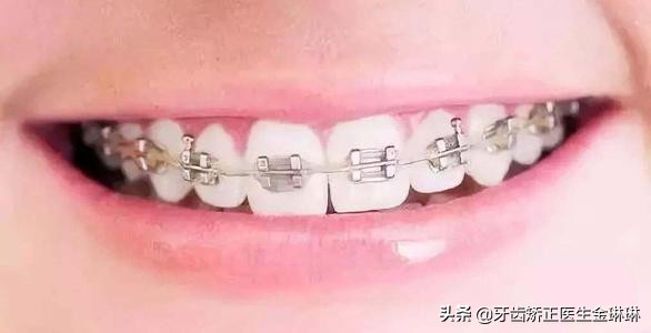 宝宝反颌需要舌系带,宝宝反颌多大能看出来