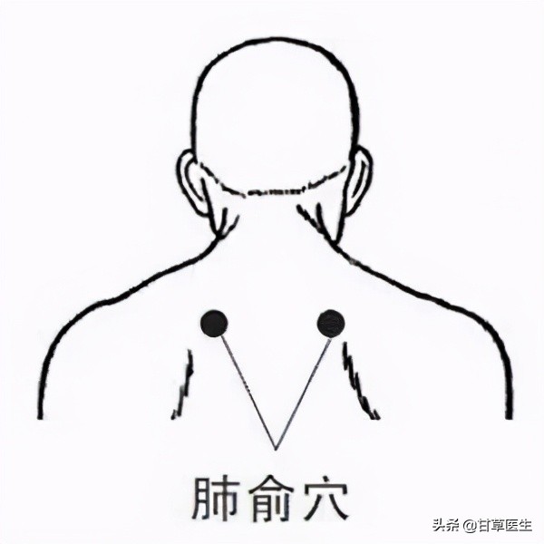 痰黄吃什么祛痰止咳,痰多用什么秘方治疗最佳