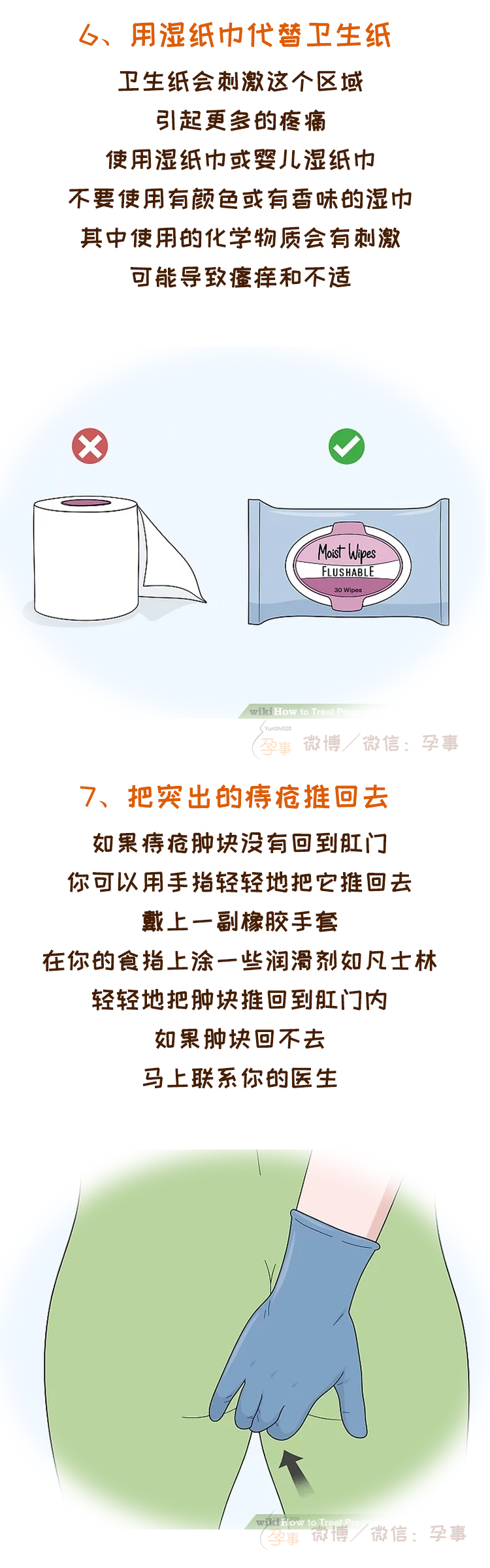 痔疮手术十六天了在家怎么护理,孕妇痔疮犯了怎么办小妙招