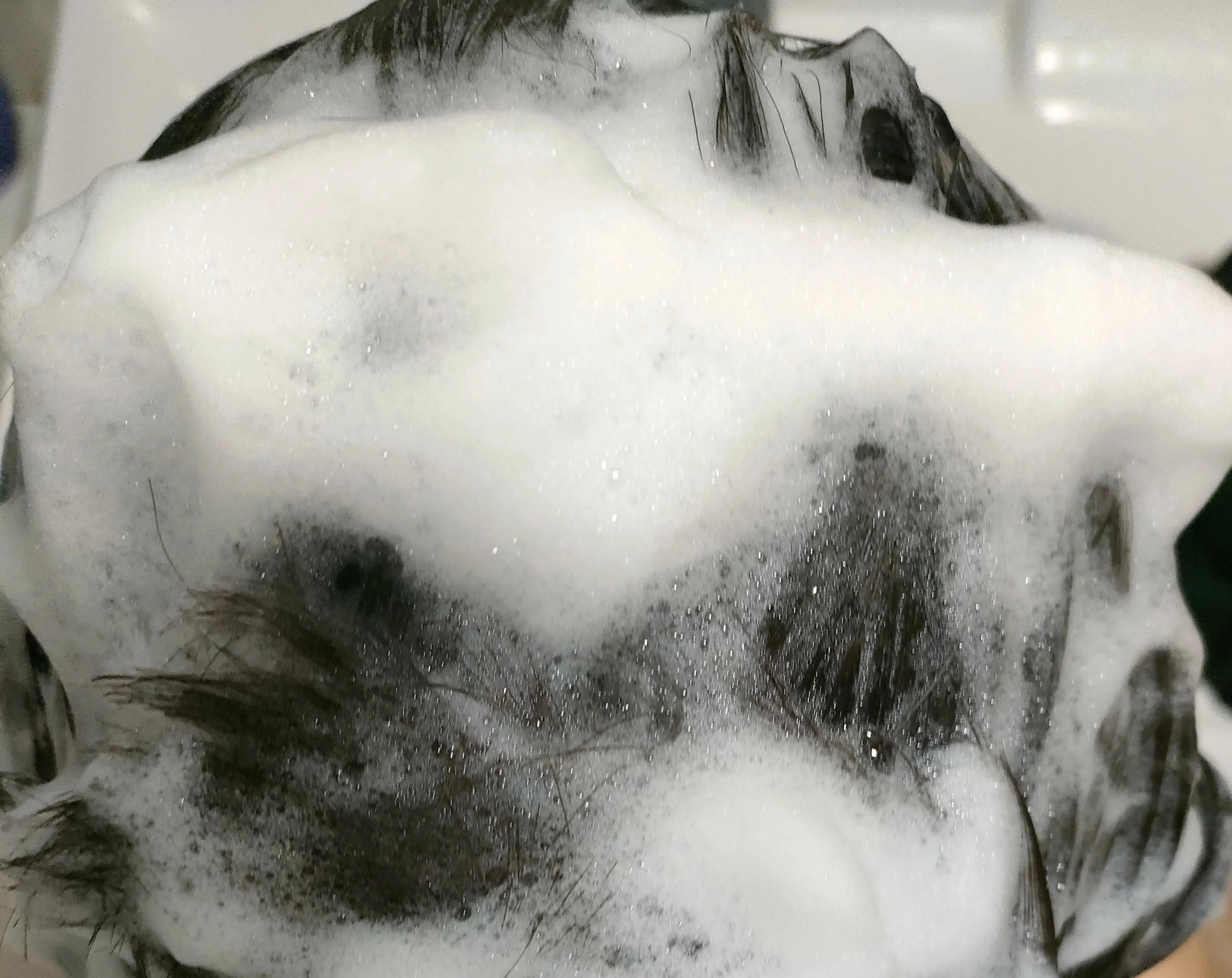 宝藏止痒洗发水,宝藏自动控油的蓬松洗发水