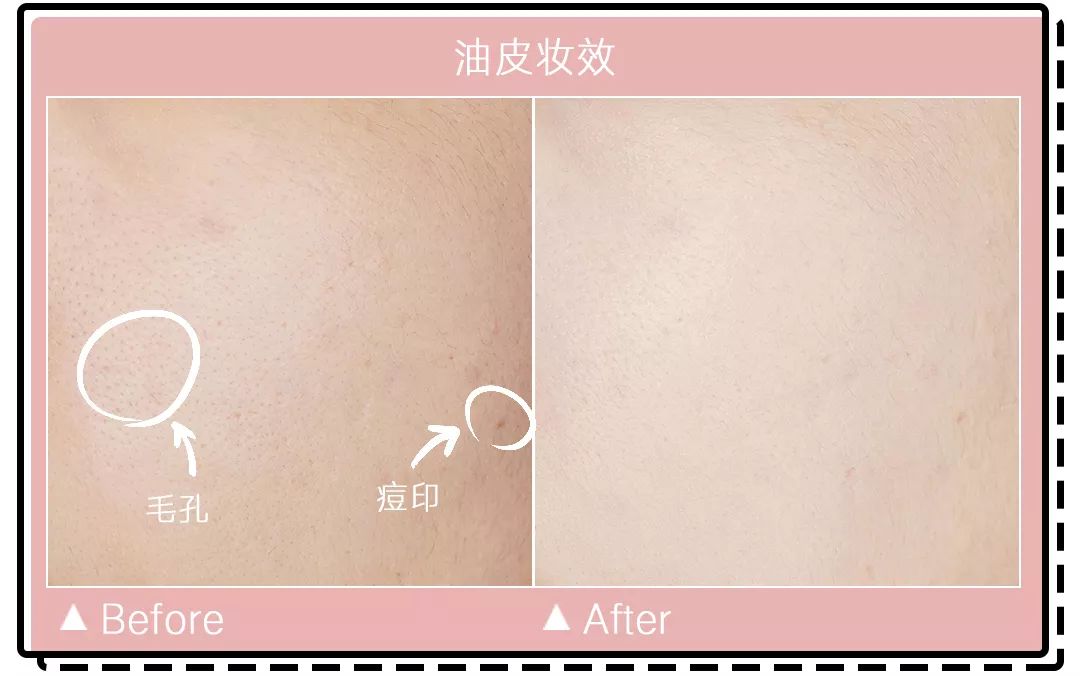 十大公认好用的混油皮粉底液排名,珀莱雅粉底液适合干皮还是油皮