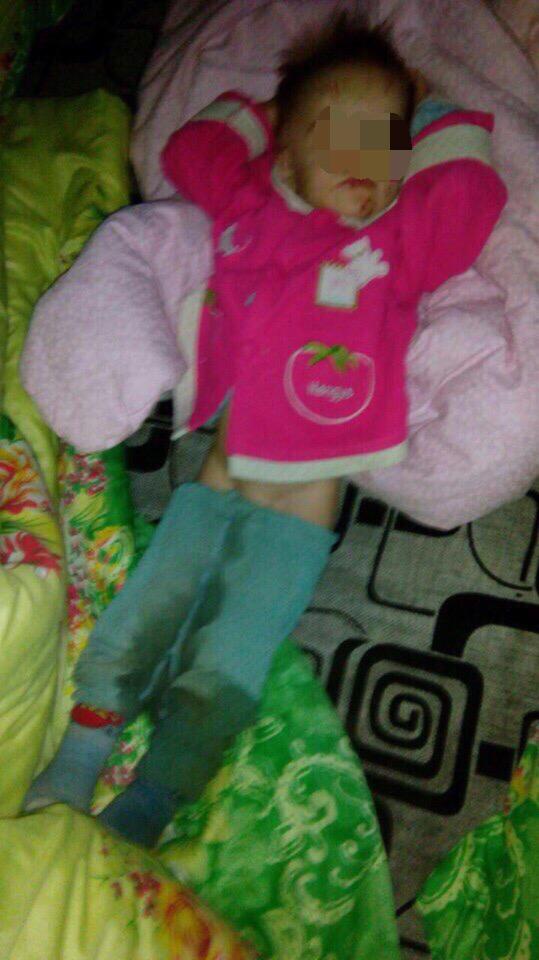 牙齿掉落,耻骨骨折…俄2岁女童遭生母虐待,竟因长得像父亲