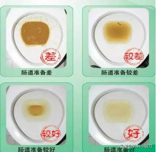 肠镜检查前喝什么泻药,肠镜检查前泻药该怎么喝