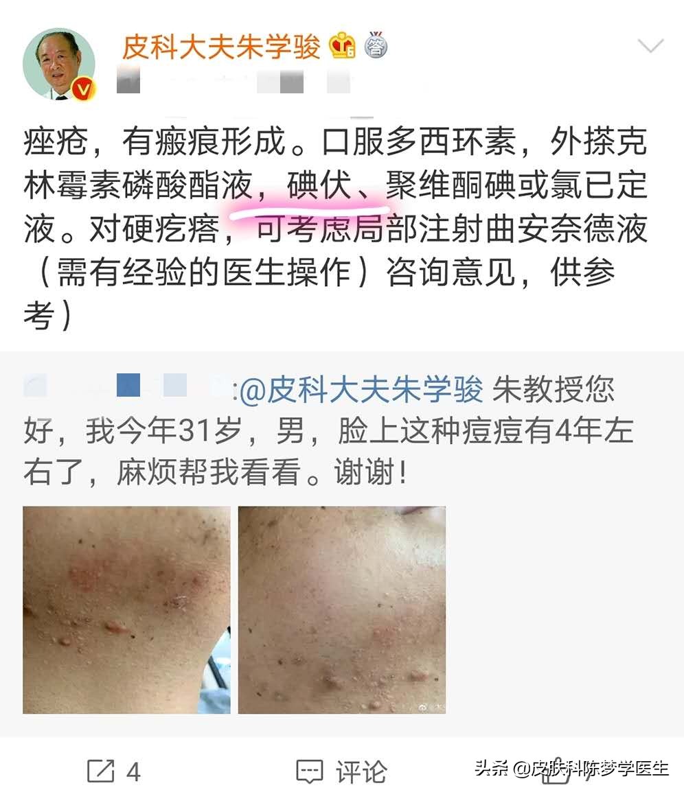 起痘痘用碘伏有用吗,碘伏加水可以治痘痘吗