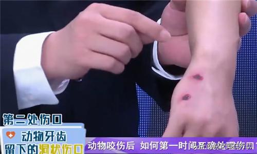 被宠物狗挠了破皮要打狂犬疫苗吗,被哪些动物抓伤需要打狂犬病疫苗