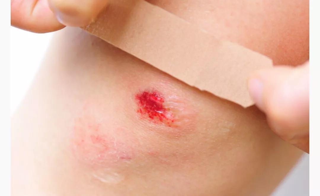 家用碘伏怎么稀释,紫药水碘伏双氧水医用酒精