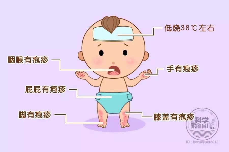 冬季手足口病症状,关于手足口病高发期的温馨提示