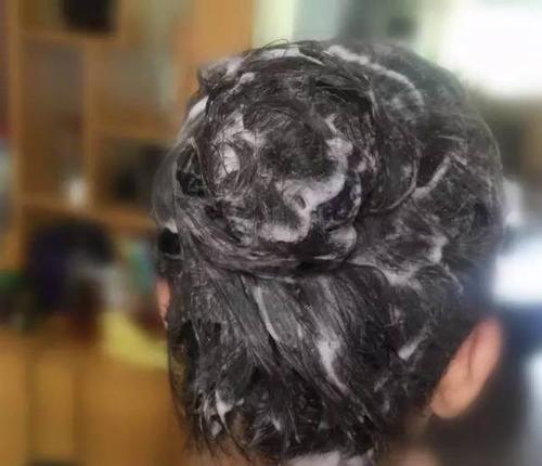 头皮长痘痘5个原因你该反省一下,头皮上长痘痘是什么原因如何处理