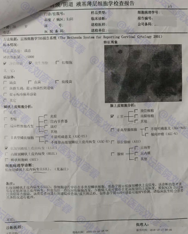 你的另一半可能会造成女性宫颈癌,为什么呢?这之间有什么关系?