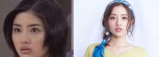 韩式整容怎么样,韩式整形对比