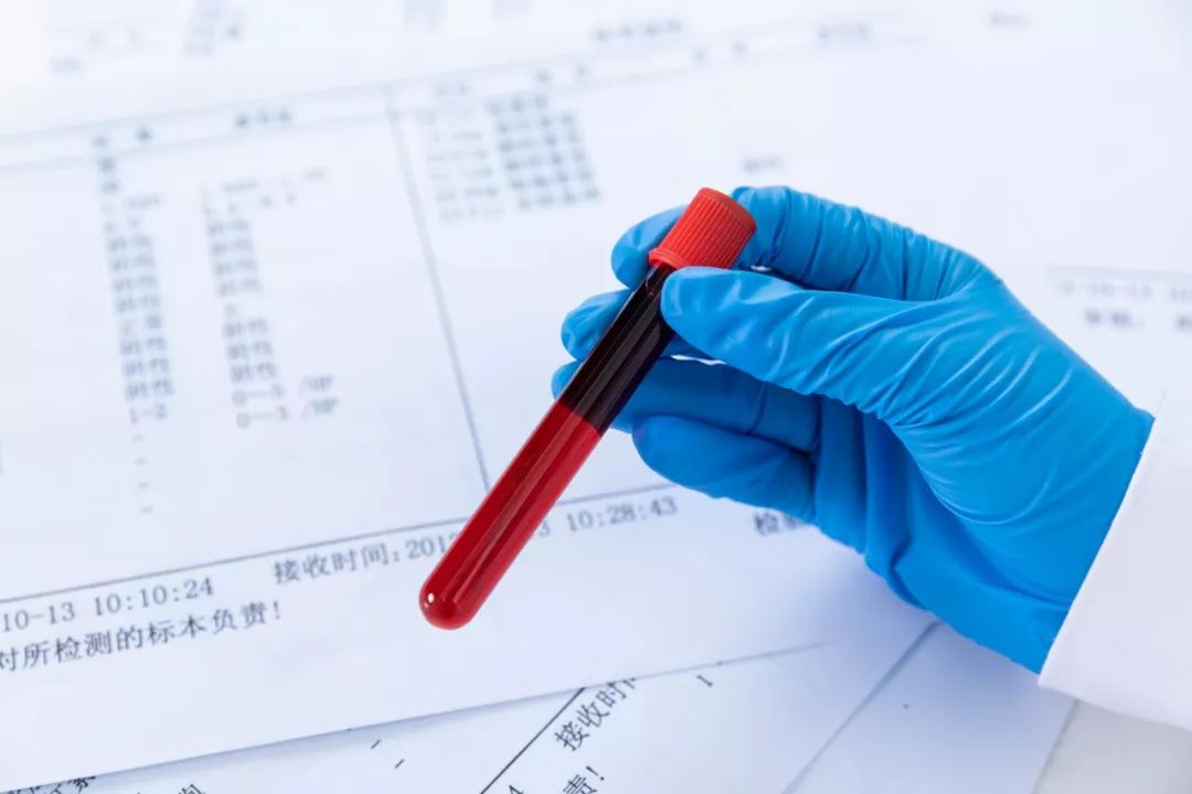 孕酮高了不能移植怎么办,移植前孕酮高怎么降下来