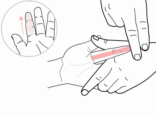 科普儿童发热怎么办,宝宝发热科普知识视频