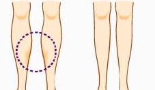小腿紧绷发硬越来越粗怎么瘦,小腿特别粗全是肌肉怎么瘦啊
