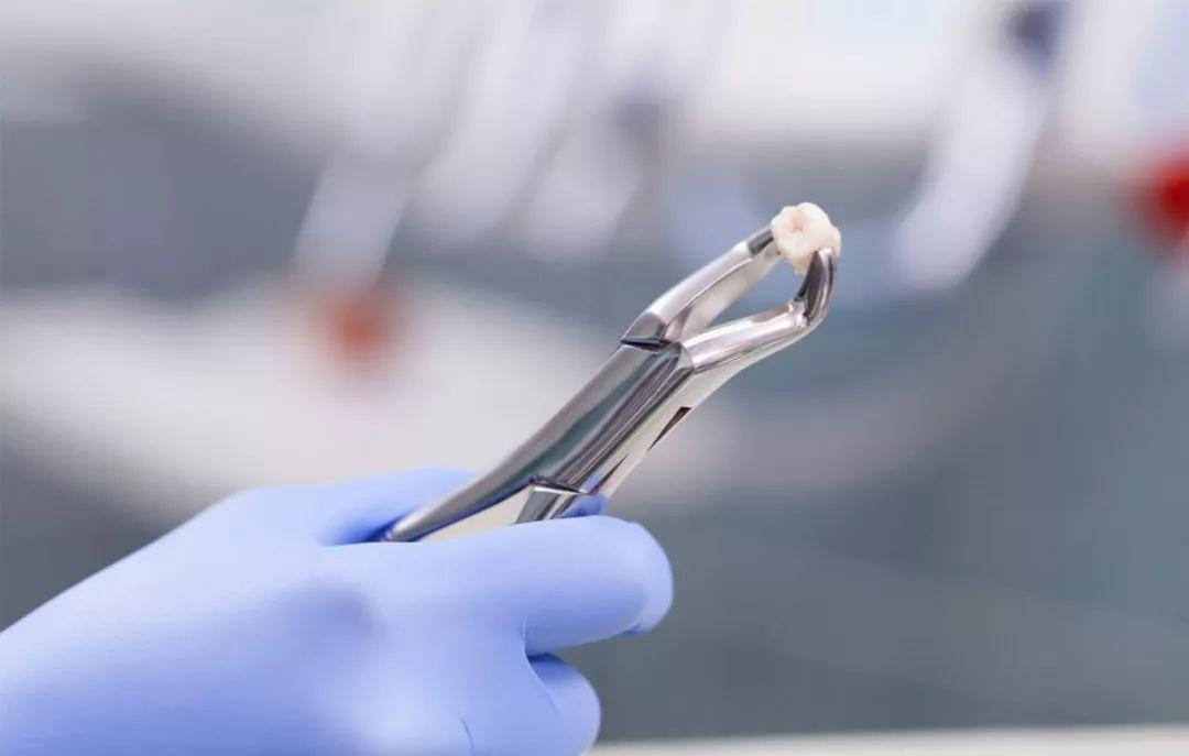 拔牙后牙龈肿胀发烧怎么办,拔牙引起发烧吃什么消炎药