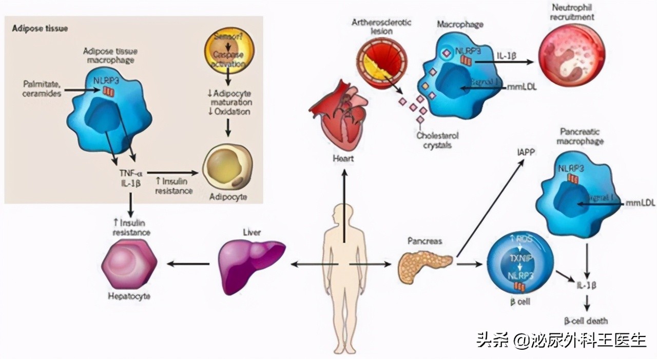 老年人怎样预防前列腺增生,预防前列腺增生最佳锻炼操