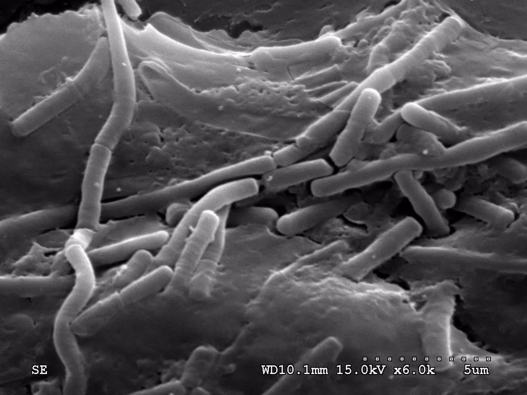 瑞士乳杆菌的健康促进作用