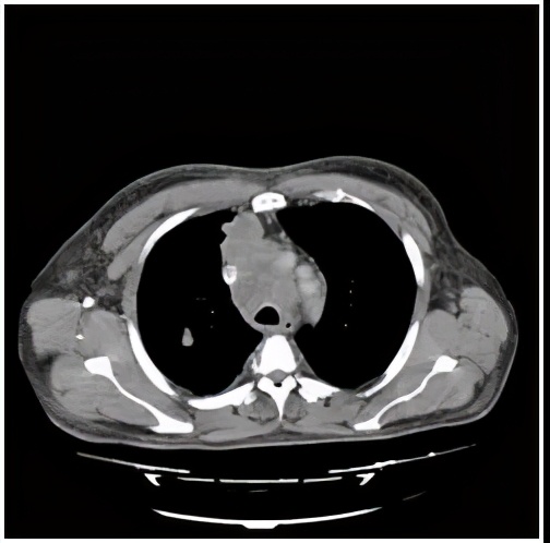 奇迹再现治愈版,医学奇迹再现视频
