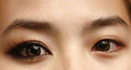 眼袋越来越严重怎样才能改善眼袋,眼袋有皱褶最简单的去眼袋的方法