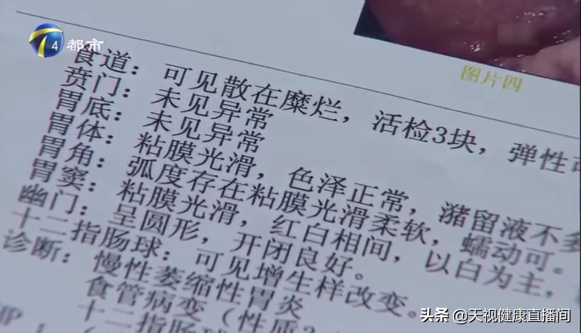 晚上喝酒睡觉反酸水呛醒怎么解决,吃了烧烤半夜被反酸呛醒后怎么办