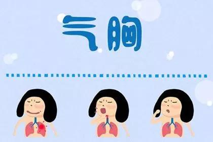 只有一个肺有气胸会危及生命吗,慢阻肺引发的气胸危及生命吗