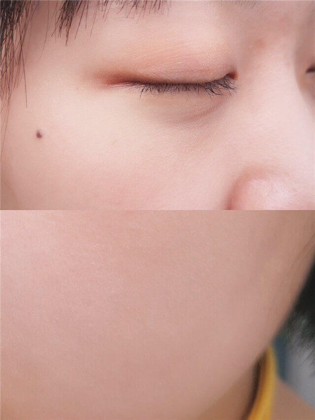 所有皱纹怎么去处理,各种皱纹去除