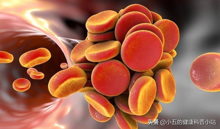 能稳定斑块的中成药,既能降压又能降脂的药