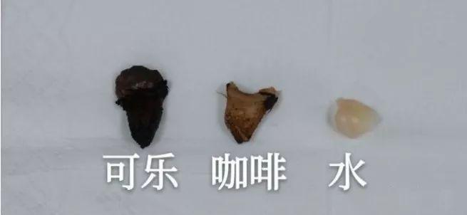 大连口腔医院颌面外科专家,怎么快速治疗牙齿敏感怕冷怕热