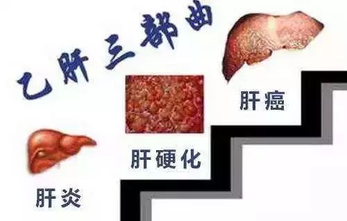 同时得艾滋病梅毒乙肝是什么后果,艾滋病梅毒乙肝会通过尿液传播吗