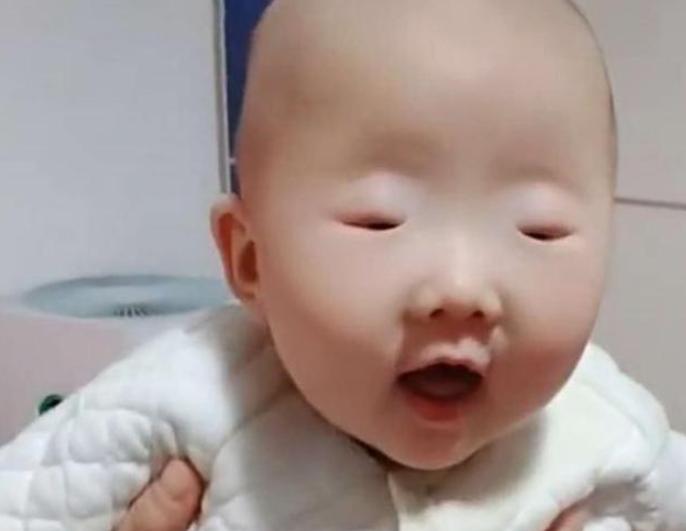 全网眼睛最小宝宝火了，李荣浩都要甘拜下风，网友：芝麻吃多了？