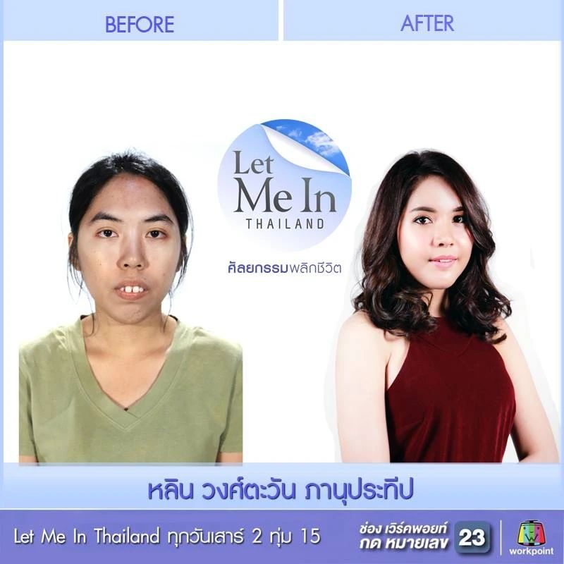 泰国最逆天的不是变性，而是堪比换头的整形